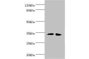 Western blot All lanes: RPH3AL antibody at 12 μg/mL Lane 1: LO2 whole cell lysate Lane 2: K562 whole cell lysate Secondary Goat polyclonal to rabbit IgG at 1/10000 dilution Predicted band size: 35, 32 kDa Observed band size: 35 kDa (RPH3AL 抗体  (AA 161-315))