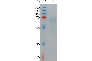 SDS-PAGE (SDS) image for Interleukin 12 (IL12) (AA 23-219) protein (Fc-His Tag) (ABIN7491453)