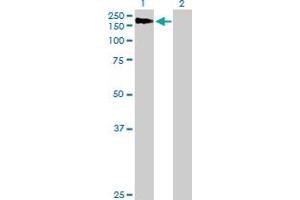 Western Blot analysis of AGL expression in transfected 293T cell line by AGL MaxPab polyclonal antibody. (AGL 抗体  (AA 1-1532))