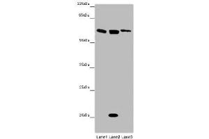Western blot All lanes: SRF antibody at 12 μg/mL Lane 1: Mouse heart tissue Lane 2: NIH/3T3 whole cell lysate Lane 3: MCF-7 whole cell lysate Secondary Goat polyclonal to rabbit IgG at 1/10000 dilution Predicted band size: 52 kDa Observed band size: 62, 21 kDa (SRF 抗体  (AA 57-269))