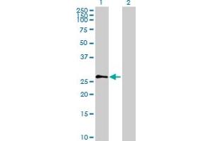 Western Blot analysis of PRSS2 expression in transfected 293T cell line by PRSS2 MaxPab polyclonal antibody. (PRSS2 抗体  (AA 1-247))