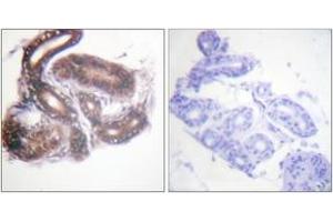 Immunohistochemistry analysis of paraffin-embedded human skin tissue, using HDAC3 (Ab-424) Antibody. (HDAC3 抗体  (AA 379-428))