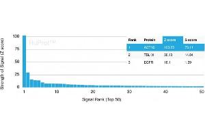 Analysis of Protein Array containing more than 19,000 full-length human proteins using Sarcomeric Actinin Alpha 2 Mouse Monoclonal Antibody (ACTN2/3293). (ACTN2 抗体  (AA 557-692))