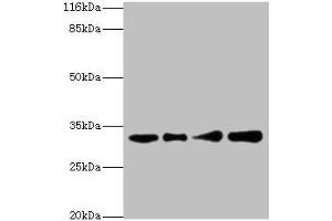 Western blot All lanes: RSU1 antibody at 2 μg/mL Lane 1: Human placenta tissue Lane 2: Caco-2 whole cell lysate Lane 3: Jurkat whole cell lysate Lane 4: HepG2 whole cell lysate Secondary Goat polyclonal to rabbit IgG at 1/10000 dilution Predicted band size: 32, 26 kDa Observed band size: 32 kDa (RSU1 抗体  (AA 117-277))