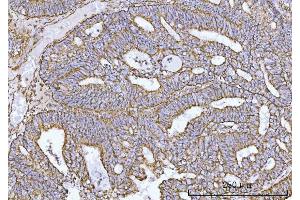 IHC analysis of COX5B using anti-COX5B antibody (ABIN7598975).