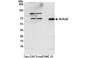 anti-Kelch-Like Family Member 42 (KLHL42) (AA 400-450) antibody