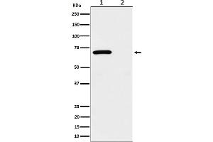 Western blot analysis of Phospho-Chk2 (T68) expression in (1) 293 treated with UV and Untreated cell lysate, (2) Untreated.