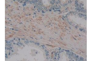 DAB staining on IHC-P; Samples: Human Prostate Tissue (MMP14 抗体  (AA 322-541))