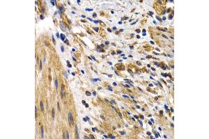 Immunohistochemistry of paraffin-embedded human normal colon using HSPB8 antibody (ABIN5971347) at dilution of 1/200 (40x lens). (HSPB8 抗体)