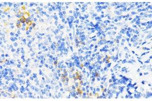 Immunohistochemistry of paraffin-embedded Mouse spleen using CAMP Polyclonal Antibody at dilution of 1:200 (40x lens). (Cathelicidin 抗体)