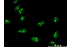 Immunofluorescence of monoclonal antibody to TASP1 on HeLa cell. (TASP1 抗体  (AA 1-420))