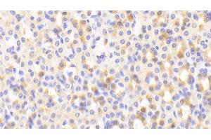 Detection of NFE2L2 in Rat Stomach Tissue using Polyclonal Antibody to Nuclear Factor, Erythroid Derived 2 Like Protein 2 (NFE2L2) (NRF2 抗体  (AA 382-604))