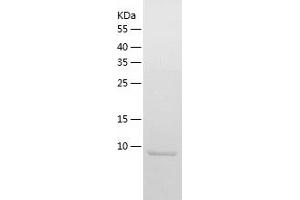Western Blotting (WB) image for S100 Calcium Binding Protein A12 (S100A12) (AA 2-92) protein (His tag) (ABIN7124951) (S100A12 Protein (AA 2-92) (His tag))