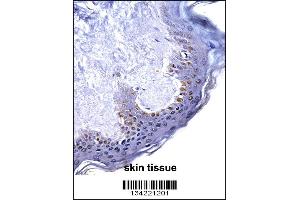 HOXC4 Antibody immunohistochemistry analysis in formalin fixed and paraffin embedded human skin tissue followed by peroxidase conjugation of the secondary antibody and DAB staining. (HOXC4 抗体  (C-Term))