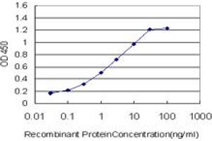 Detection limit for recombinant GST tagged PGR is approximately 0. (Progesterone Receptor 抗体  (AA 1-110))