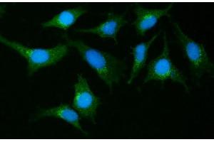 IF analysis of GIT1 using anti-GIT1 antibody (ABIN7601683). (GIT1 抗体  (AA 415-736))