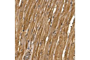 Immunohistochemistry of paraffin-embedded rat heart using R Rabbit pAb (ABIN6133143, ABIN6146576, ABIN6146578 and ABIN6224057) at dilution of 1:100 (40x lens). (RAB35 抗体  (AA 1-201))