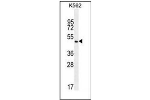 PIP5KL1 antibody  (N-Term)