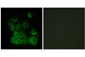 Immunofluorescence analysis of A549 cells, using BAX (Phospho-Thr167) antibody. (BAX 抗体  (pThr167))