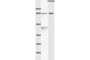 Rat brain lysates probed with Anti PI3K/PI3 kinase p85 alpha subunit Polyclonal Antibody, Unconjugated (ABIN725405) at 1:200 in 4 °C. (PIK3R1 抗体  (AA 501-600))