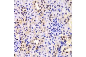 Immunohistochemistry of paraffin-embedded mouse kidney using HNRNPA1 Antibody (ABIN5975570) at dilution of 1/100 (40x lens). (HNRNPA1 抗体)