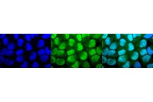 Immunocytochemistry/Immunofluorescence analysis using Rabbit Anti-Methylated Lysine Polyclonal Antibody (ABIN5650776). (Lysine (lys) (methylated) 抗体)