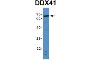 Western Blotting (WB) image for anti-DEAD (Asp-Glu-Ala-Asp) Box Polypeptide 41 (DDX41) (N-Term) antibody (ABIN2775230)