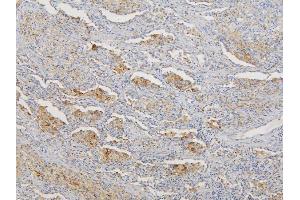 IHC analysis of RNF123 using anti-RNF123 antibody (ABIN6719387).