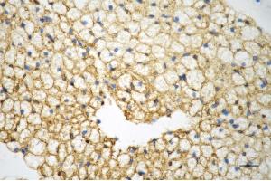 Immunohistochemistry was performed on paraffin-embedded mouse brown adipose tissue using caveolin 1 antibody (ABIN7797944), 1:200). (Recombinant Caveolin-1 抗体)