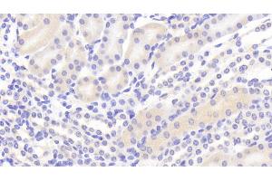 Detection of PCSK9 in Mouse Kidney Tissue using Polyclonal Antibody to Proprotein Convertase Subtilisin/Kexin Type 9 (PCSK9)