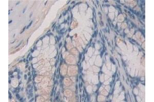 Immunohistochemistry (IHC) image for anti-Estrogen Receptor 1 (ESR1) (AA 233-483) antibody (ABIN7433072)