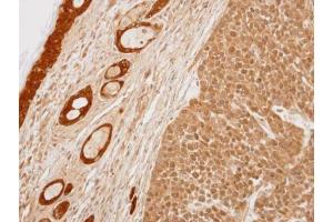 IHC-P Image Immunohistochemical analysis of paraffin-embedded 59T xenograft, using 14-3-3 sigma, antibody at 1:100 dilution. (14-3-3 sigma/SFN 抗体  (C-Term))