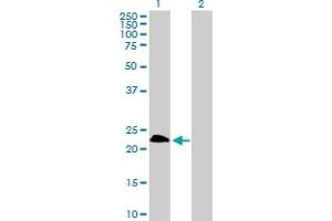 Western Blotting (WB) image for TWIST1 293T Cell Transient Overexpression Lysate(Denatured) (ABIN1333820)