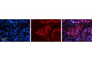 Rabbit Anti-HSPA4 Antibody   Formalin Fixed Paraffin Embedded Tissue: Human Testis Tissue Observed Staining: Cytoplasm in spermatogonia and Leydig cells Primary Antibody Concentration: 1:100 Other Working Concentrations: 1:600 Secondary Antibody: Donkey anti-Rabbit-Cy3 Secondary Antibody Concentration: 1:200 Magnification: 20X Exposure Time: 0. (HSPA4 抗体  (N-Term))