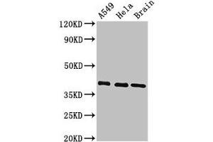 Western Blot Positive WB detected in: A549 whole cell lysate, Hela whole cell lysate, Mouse brain tissue All lanes: HLA-C antibody at 3. (HLA-C 抗体  (AA 62-306))