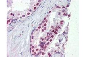 FOXA1 polyclonal antibody  (5 ug/mL) staining of paraffin embedded human prostate. (FOXA1 抗体  (C-Term))
