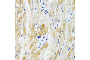 Immunohistochemistry of paraffin-embedded mouse heart using PHPT1 antibody. (PHPT1 抗体  (AA 1-125))