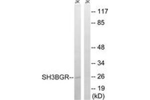 Western blot analysis of extracts from Jurkat cells, using SH3BGR Antibody. (SH3BGR 抗体  (AA 81-130))
