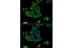 Immunofluorescence analysis of U2OS cells using TGM3 antibody (ABIN6132263, ABIN6149094, ABIN6149095 and ABIN6221560). (TGM3 抗体  (AA 1-180))