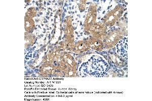 Rabbit Anti-CYP4A22 Antibody  Paraffin Embedded Tissue: Human Kidney Cellular Data: Epithelial cells of renal tubule Antibody Concentration: 4. (CYP4A22 抗体  (N-Term))