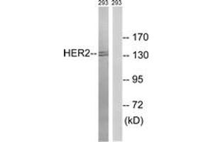 Western blot analysis of extracts from 293 cells, treated with Ca2+ 40nM 30', using HER2 (Ab-1112) Antibody. (ErbB2/Her2 抗体  (AA 1081-1130))