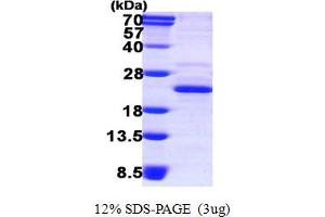 SDS-PAGE (SDS) image for DCTP Pyrophosphatase 1 (DCTPP1) (AA 1-170) protein (His tag) (ABIN667657) (DCTPP1 Protein (AA 1-170) (His tag))
