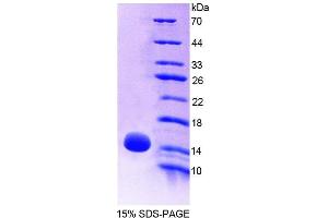 SDS-PAGE analysis of Mouse OT Protein. (OXT 蛋白)