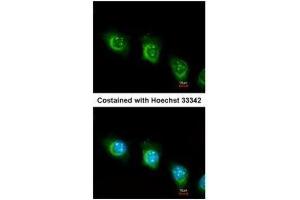 ICC/IF Image Immunofluorescence analysis of methanol-fixed HeLa, using USP47, antibody at 1:200 dilution. (USP47 抗体)