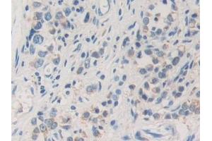 Immunohistochemistry (IHC) image for anti-Acetyl-CoA Acetyltransferase 2 (ACAT2) (AA 1-397) antibody (ABIN7435556)