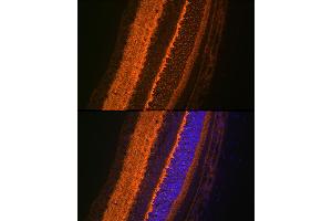 Immunofluorescence analysis of rat eye using V Rabbit mAb (ABIN7271313) at dilution of 1:100 (40x lens). (VAMP2 抗体)