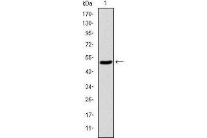 Western blot analysis using KID mAb against human KID (AA: 225-419) recombinant protein. (KIF22 抗体)