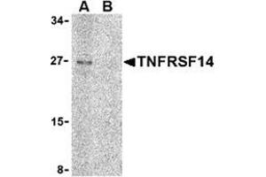 Western blot analysis of TNFRSF14 in Raji cell lysate with this product at 2 μg/ml in (A) the absence and (B) the presence of blocking peptide.