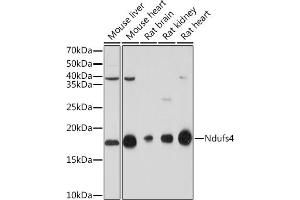 Western blot analysis of extracts of various cell lines, using NDUFS4 Rabbit mAb (ABIN7268821) at 1:1000 dilution. (NDUFS4 抗体)