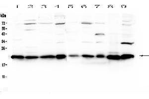 Western blot analysis of HP1 gamma using anti-HP1 gamma antibody . (CBX3 抗体  (AA 2-183))